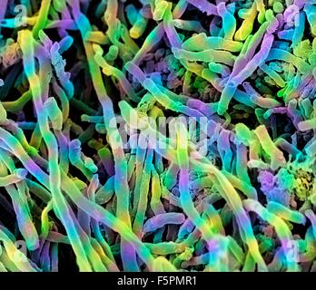 Streptomyces coelicoflavus bacteria. Coloured scanning electron micrograph (SEM) of strands of Streptomyces coelicoflavus Stock Photo