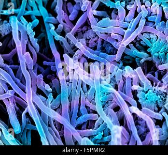 Streptomyces coelicoflavus bacteria. Coloured scanning electron micrograph (SEM) of strands of Streptomyces coelicoflavus Stock Photo