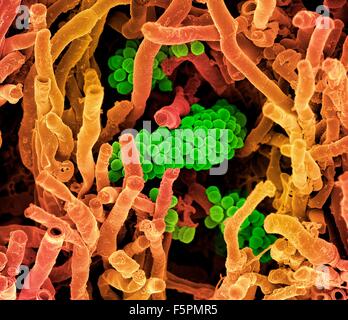 Streptomyces coelicoflavus bacteria. Coloured scanning electron micrograph (SEM) of Streptomyces coelicoflavus bacteria Stock Photo