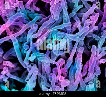 Actinomyces viscosus bacteria. Coloured scanning electron micrograph (SEM) of strands of Actinomyces viscosus. Actinomyces Stock Photo