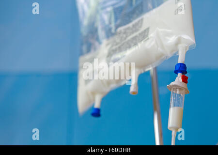 Close up of Total Parenteral Nutrition (TPN) fluids bag on IV stand for feeding person intravenously, bypassing usual process of eating and digestion  Model Release: No.  Property Release: No. Stock Photo