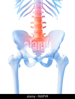 medical 3d illustration of a painful lumbar spine Stock Photo - Alamy