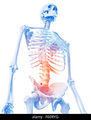 medical 3d illustration of a painful lumbar spine Stock Photo