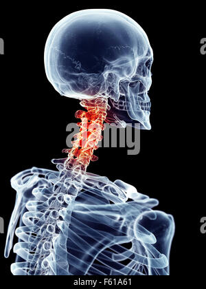 Painful cervical spine, illustration Stock Photo - Alamy