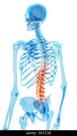 medically accurate illustration - painful lumbar spine Stock Photo - Alamy