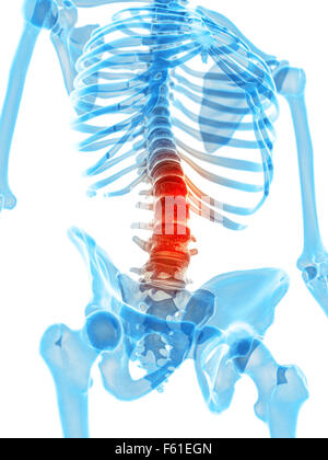 medically accurate illustration - painful lumbar spine Stock Photo