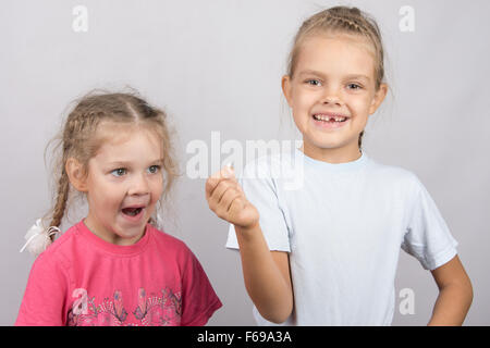 Six year old girl showing her the other girl had fallen Milk front upper teeth Stock Photo