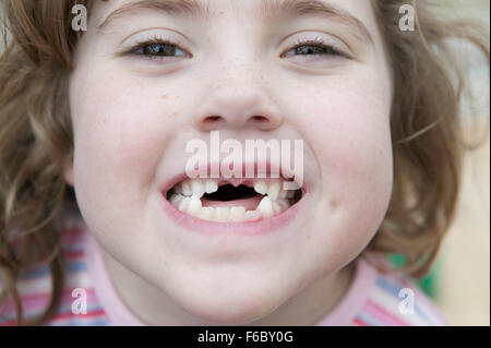 Young girl with front teeth missing smiling at the camera