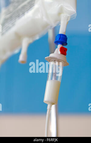 Close up of Total Parenteral Nutrition (TPN) fluids bag on IV stand for feeding person intravenously, bypassing usual process of eating and digestion  Model Release: No.  Property Release: No. Stock Photo