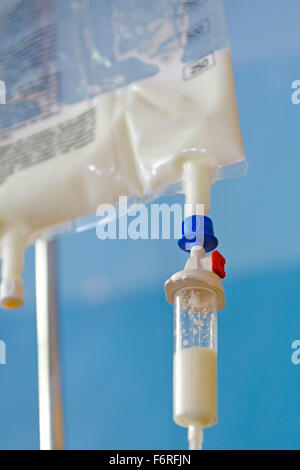 Close up of Total Parenteral Nutrition (TPN) fluids bag on IV stand for feeding person intravenously, bypassing usual process of eating and digestion  Model Release: No.  Property Release: No. Stock Photo