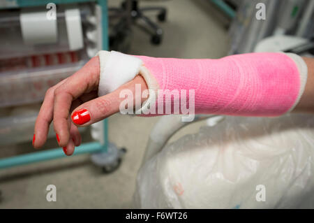 Freshly plastered lady's wrist in a pink plaster cast in a hospital accident and emergency department. Stock Photo