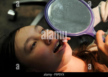 An orthodontist is a dentist who specializes in straightening crooked teeth. Female patient checking her braces with mirror. Stock Photo