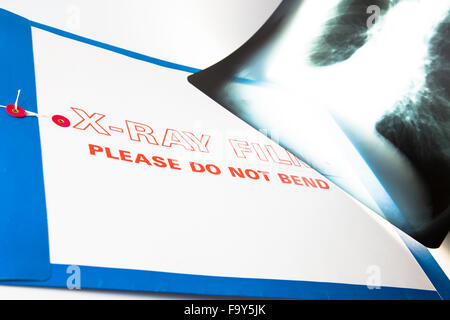 Still-Life Lung X-Ray and Record Folder, USA Stock Photo