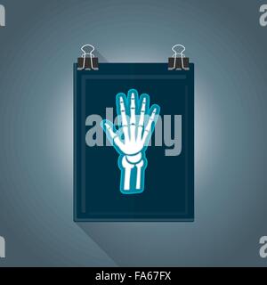 vector colored flat design x-ray radiography hand picture illustration isolated dark background long shadow Stock Vector