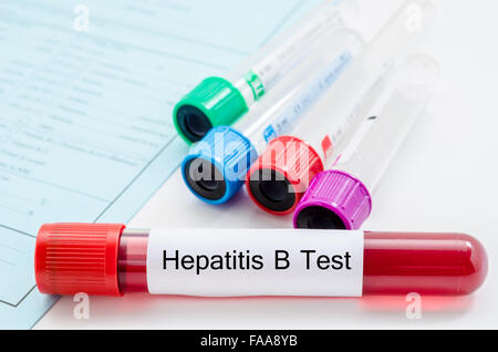 Blood sample for hepatitis B virus (HBV) testing on request form screening test. Stock Photo
