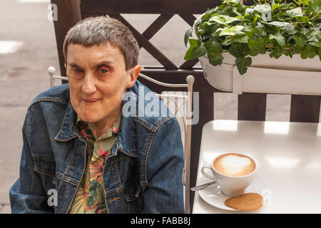 Elderly disabled man with cerebral palsy sitting in a street cafe. Stock Photo