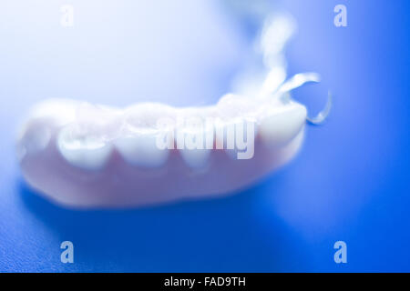 Removable partial denture metal and plastic dental false teeth prosthetics. Stock Photo