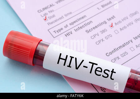 Sample blood collection tube with HIV test label on HIV infection screening test form. Stock Photo