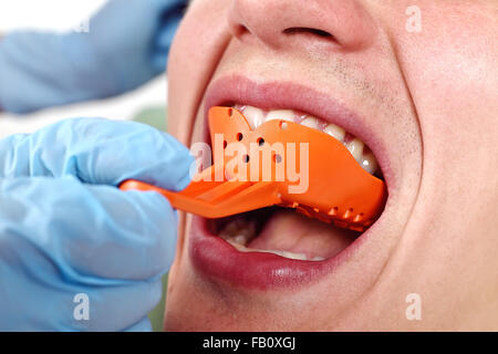 dentist inserts blade into patient's mouth for impression taking Stock Photo