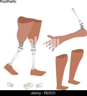 Medical Concept, Illustration Collection of Prosthetic Leg, Knee and Arm, Artificial Device That Replaces A missing Body Part. Stock Vector