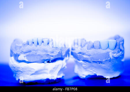 Dental prosthetics clay tooth mold in dentists photo. Stock Photo