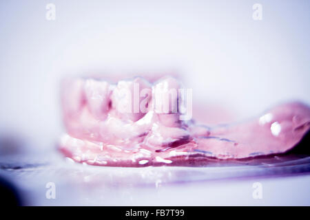 Dental prosthetics clay tooth mold in dentists photo. Stock Photo