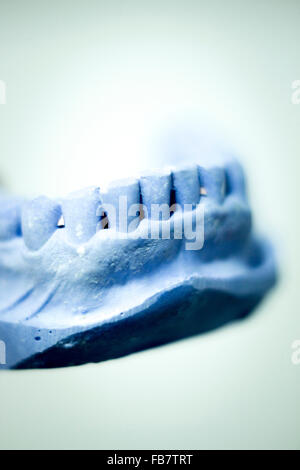 Dental prosthetics clay tooth mold in dentists photo. Stock Photo