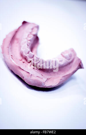 Dental prosthetics clay tooth mold in dentists photo. Stock Photo