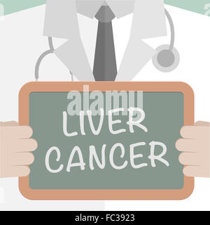 Medical Board Liver Cancer Stock Photo