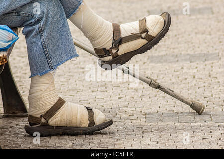 Wounded injured or crippled legs of a poor man sitting on a bench with a stick Stock Photo