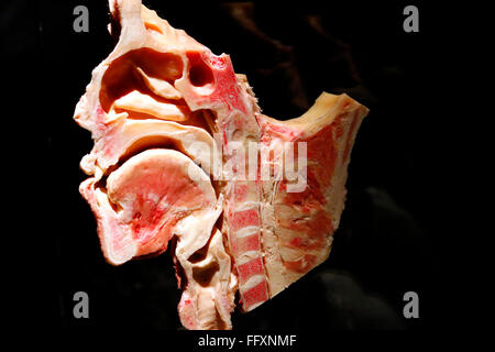 Impressionen - Eroeffnung des 'Menschen Museums' mit Plastinaten von menschlichen Koerpern, Alexanderplatz, 17. Februar 2015, Be Stock Photo