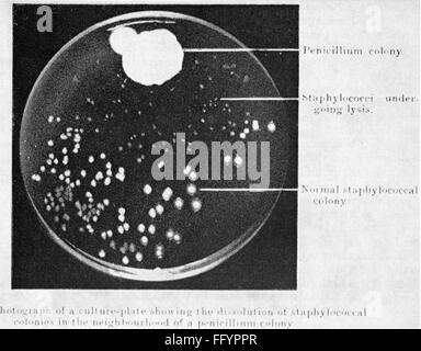 medicine, medicinal drug, penicillin, penicillium and staphylococci, original nutrition solution of Alexander Fleming (1881 - 1955), 28.9.1928, Additional-Rights-Clearences-Not Available Stock Photo