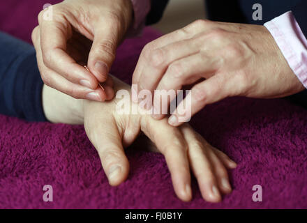 Berlin, Germany. 25th Feb, 2016. An acupuncture needle is applied to a hand in Berlin, Germany, 25 February 2016. Photo: JENS KALAENE/dpa/Alamy Live News Stock Photo