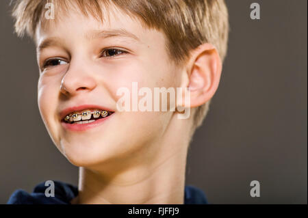 studio portrait of white boy with braces Stock Photo