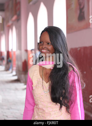 Lucknow, India. 01st Mar, 2016. Model Laxmi Saa pictured in Lucknow, India, 01 March 2016. After becoming victim to an acid attack, she did not leave her home for years but has since fought her way back to normal life. Today, Laxmi is the face of a fashion campaign, talk show host and serves as an inspiration to many other people. Photo: DOREEN FIEDLER/dpa - NO WIRE SERVICE -/dpa/Alamy Live News Stock Photo