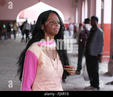 Lucknow, India. 01st Mar, 2016. Model Laxmi Saa pictured in Lucknow, India, 01 March 2016. After becoming victim to an acid attack, she did not leave her home for years but has since fought her way back into normal life. Today, Laxmi is the face of a fashion campaign, talk show host and serves as an inspiration to many other people. Photo: DOREEN FIEDLER/dpa - NO WIRE SERVICE -/dpa/Alamy Live News Stock Photo