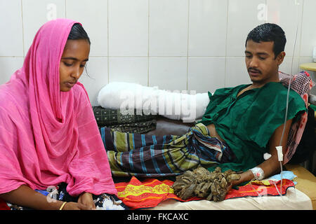 Bangladeshi Tree man Abdul Bajander rests after a surgery at Dhaka Medical College Hospital in Dhaka on Feb. 23, 2016. Stock Photo