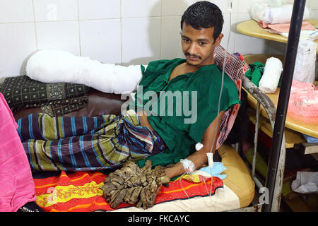 Bangladeshi Tree man Abdul Bajander rests after a surgery at Dhaka Medical College Hospital in Dhaka on Feb. 23, 2016. Stock Photo