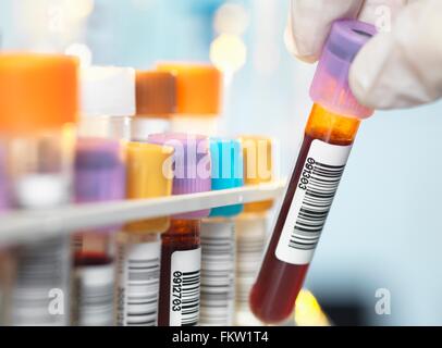 Laboratory technician preparing blood sample for medical testing in ...