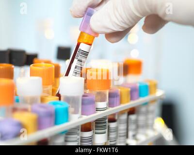 Laboratory technician preparing blood sample for medical testing in laboratory Stock Photo