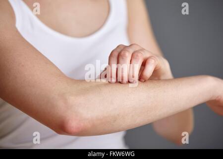 Cropped shot of young woman scratching her forearm with fingers Stock Photo