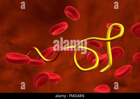 Computer illustration of Borrelia bacteria in blood. Borrelia causes relapsing fever (the most common cause is Borrelia recurrentis) and Lyme diseases (Borrelia burgdorferi). Stock Photo