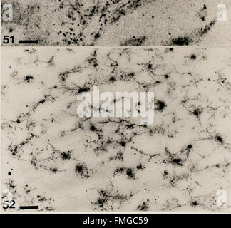 Cytological methods for the detection, identification, and characterization of orchid viruses and their inclusion bodies (1985) Stock Photo