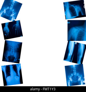 X ray film isolated on white background Stock Photo
