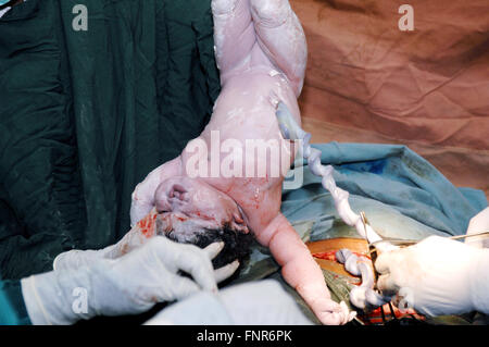 The newborn is held upside down to drain fluid from its lungs. Stock Photo