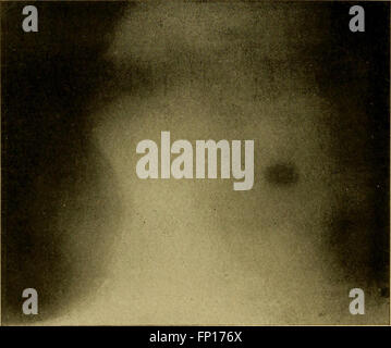 This instructional system offers a visual guide to X-ray methods and ...