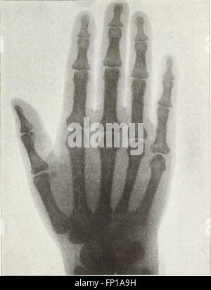 The 'American X-ray Journal' (1897) explores the emerging field of X ...