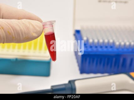 The tube of blood. The study of human blood in medical labs. Stock Photo