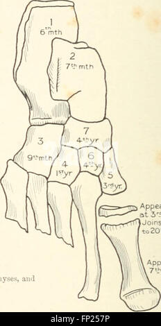 Radiography, X-ray Therapeutics and Radium Therapy (1915) covers the ...