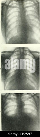 This 1915 text covers the use of radiography, X-ray therapeutics, and ...